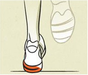 Bild 1Pronation